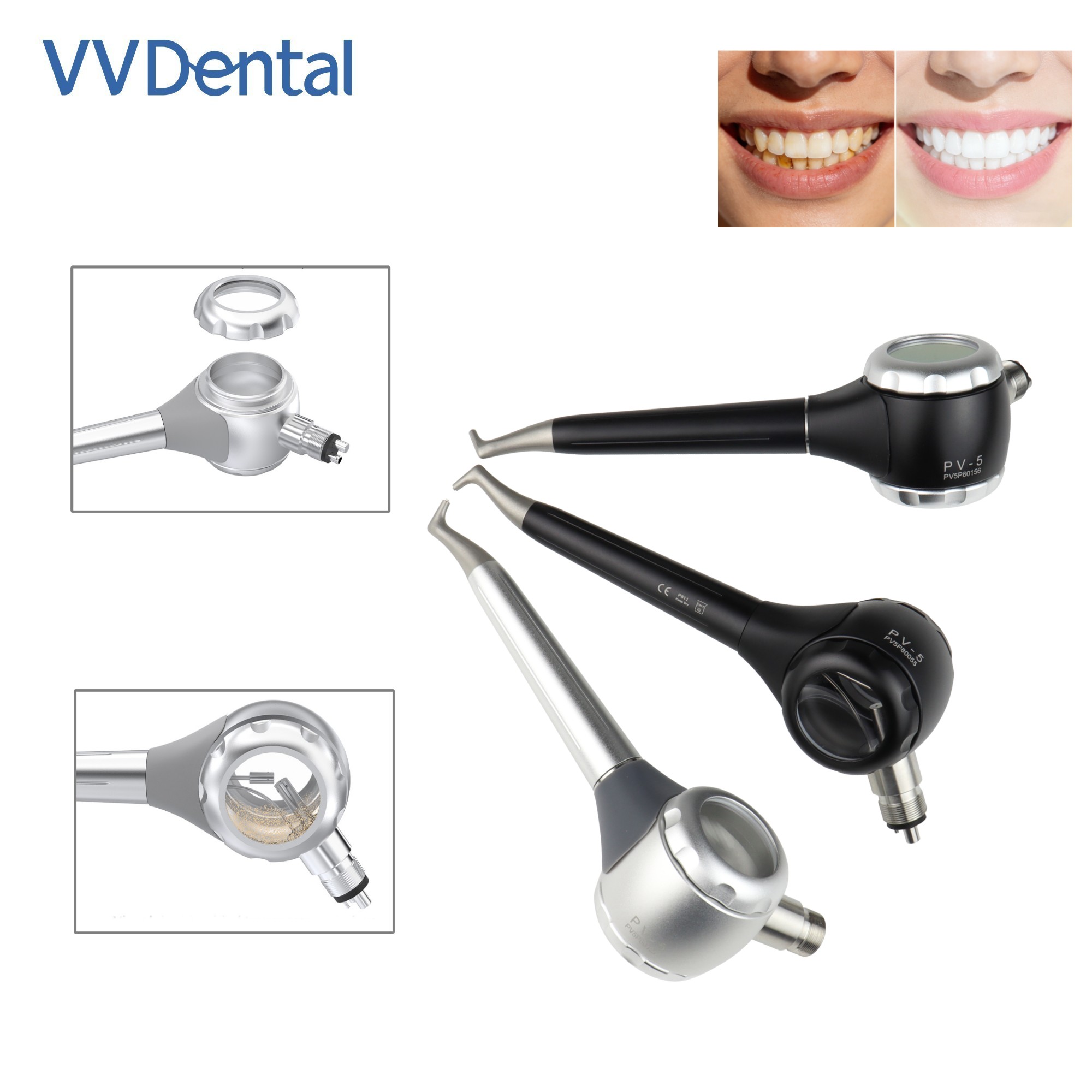 Teeth Whitening Free - Pistola de Jateamento Dental VV com