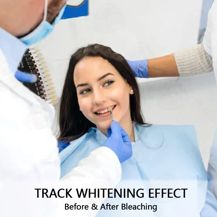 Clareamento dental profissiona - Teeth Whitening Shade Guide avaliação e preço