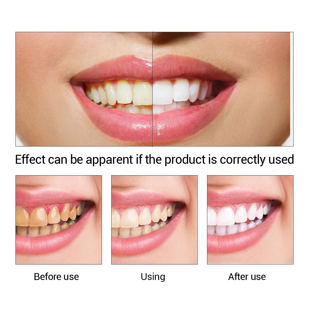 FTEENPLY Essência para claream - Teeth Whitening Instant avaliação e preço