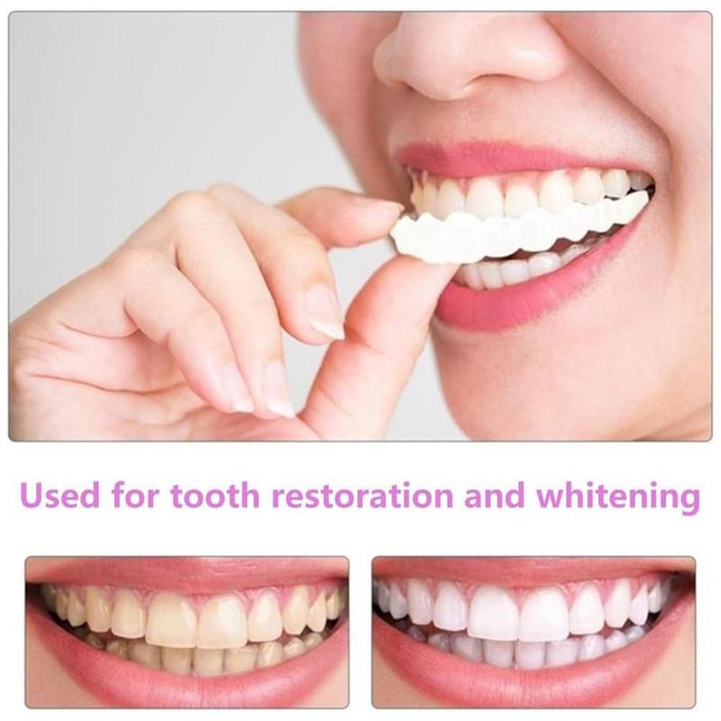 Encaixe em folheados de dentes - Teeth Whitening Instant avaliação e preço