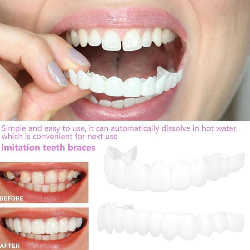 Encaixe em folheados de dentes - Teeth Whitening Instant avaliação e preço