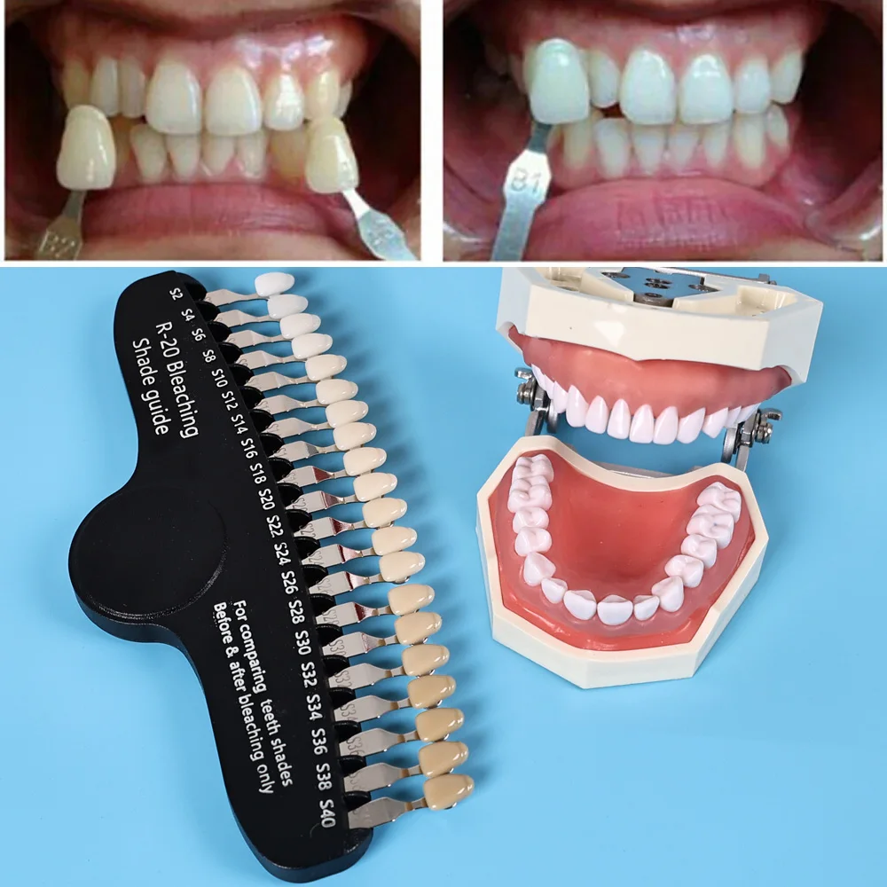 ELIJAH R-20 Guia de sombra de  - Teeth Whitening Shade Guide avaliação e preço
