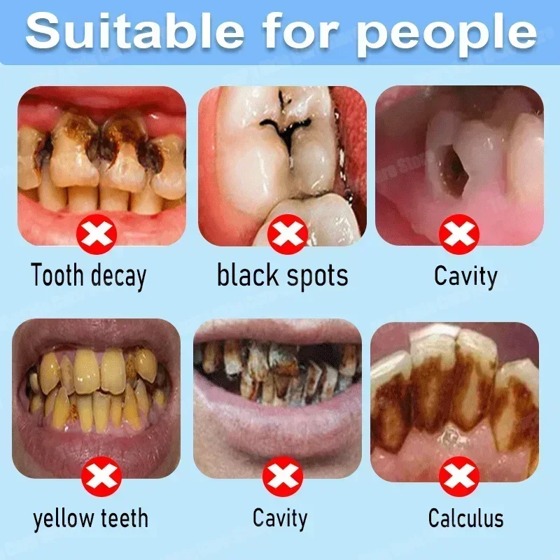 Pasta de Dente Anticáries: Rep - Teeth Whitening That Works avaliação e preço