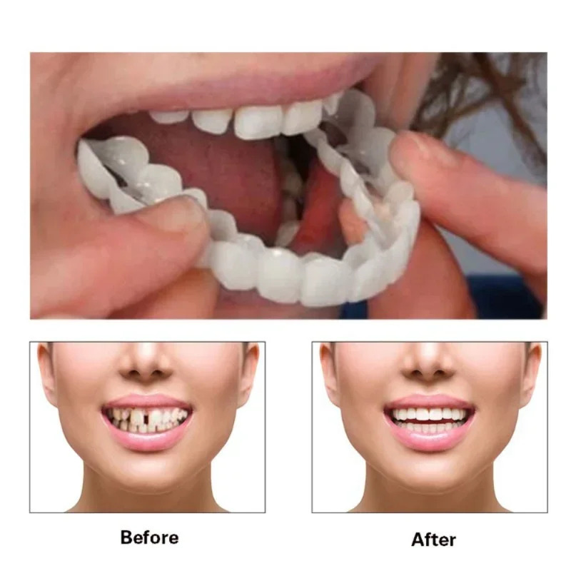 Ajuste perfeito clareamento do - Teeth Whitening Mask avaliação e preço