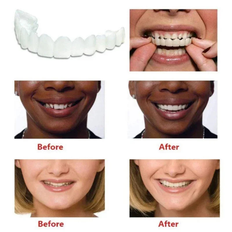 Ajuste perfeito clareamento do - Teeth Whitening Mask avaliação e preço