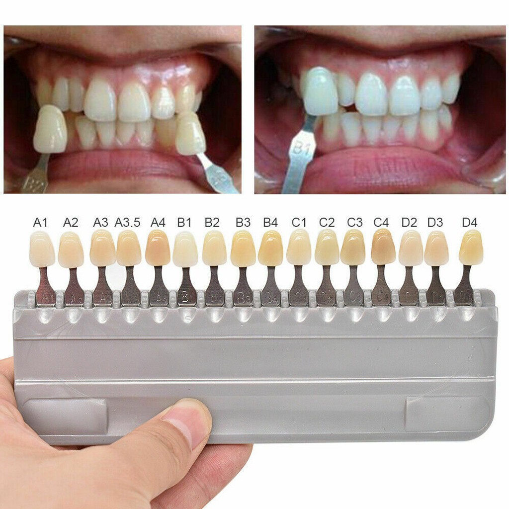 Vita guia de sombra de dentes, - Teeth Whitening Shade Guide avaliação e preço