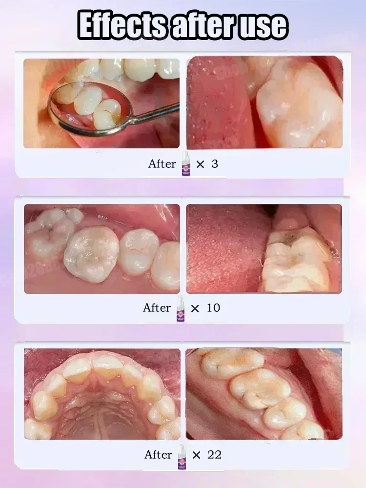 Pasta de Dente para Limpeza De - Teeth Whitening That Works avaliação e preço