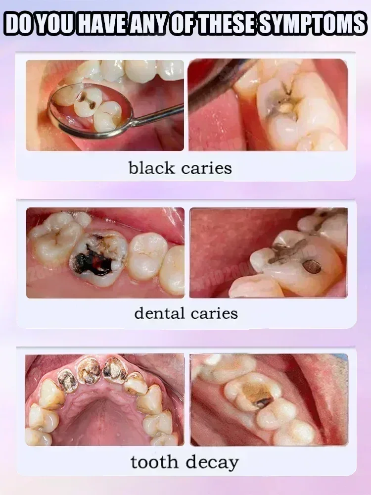 Pasta de Dente para Limpeza De - Teeth Whitening That Works avaliação e preço