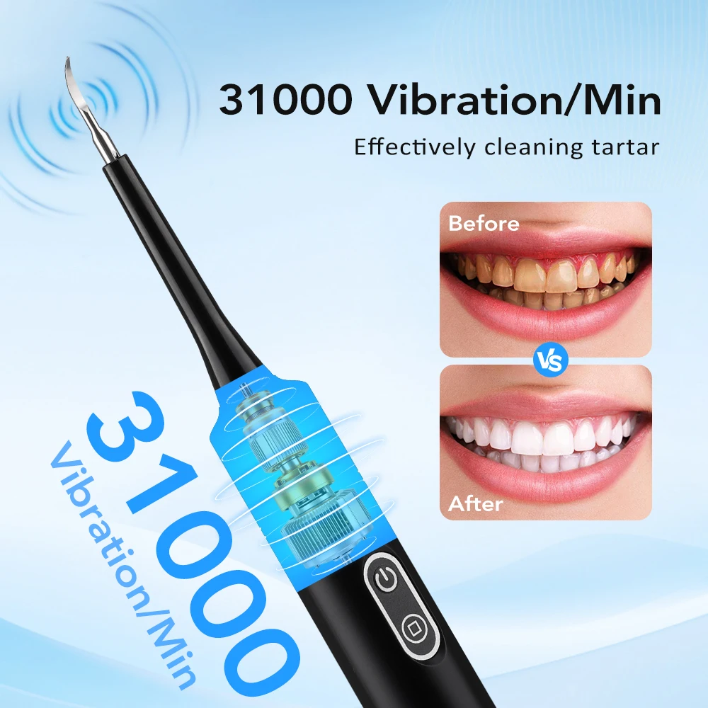 Escova de Dentes Elétrica com  - Teeth Whitening Toothbrush avaliação e preço